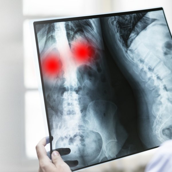 Göğüs Hastalıkları