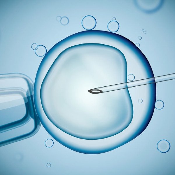 Ivf Treatment
